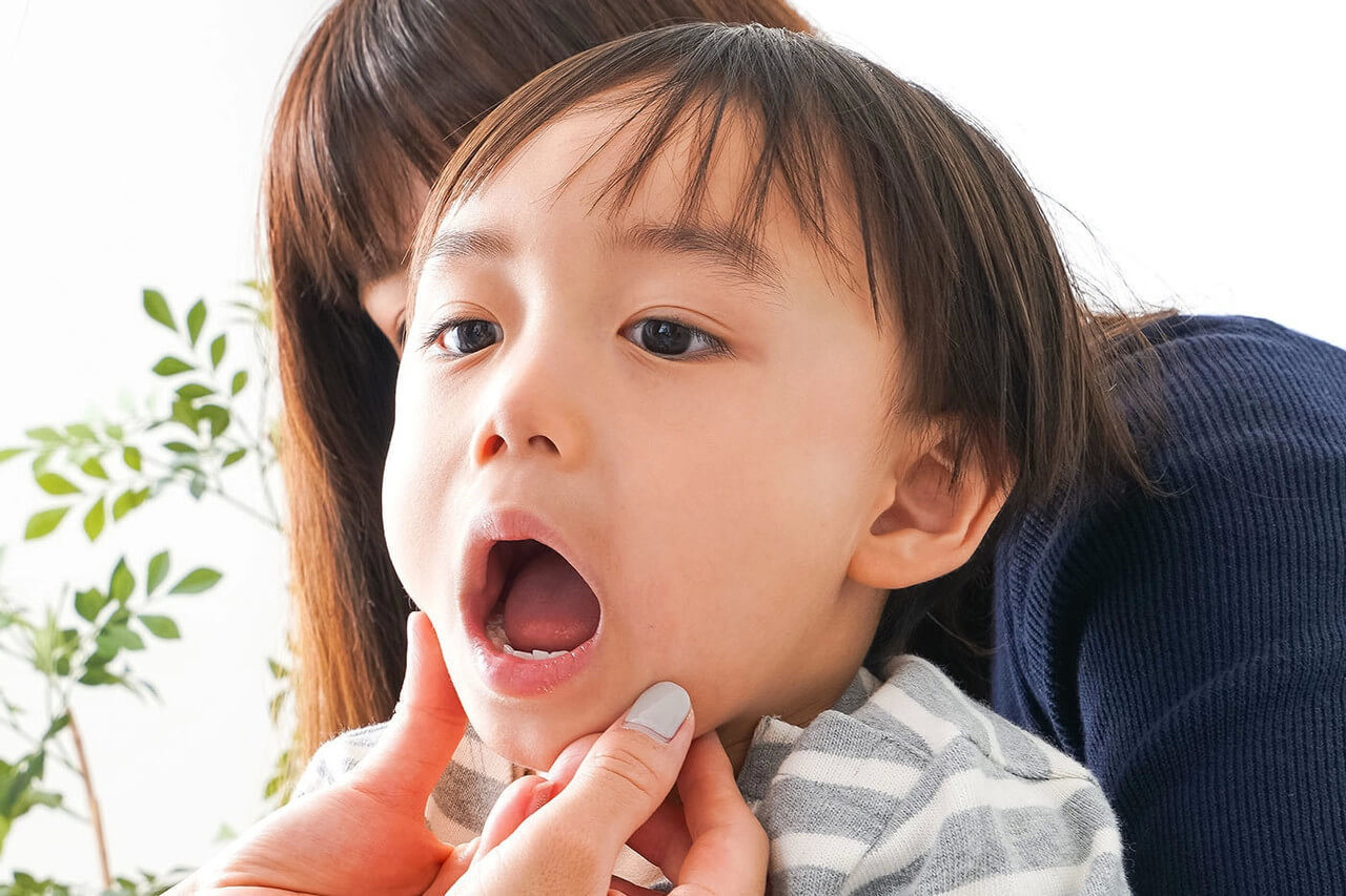 小児矯正を始める最適なタイミングとは？